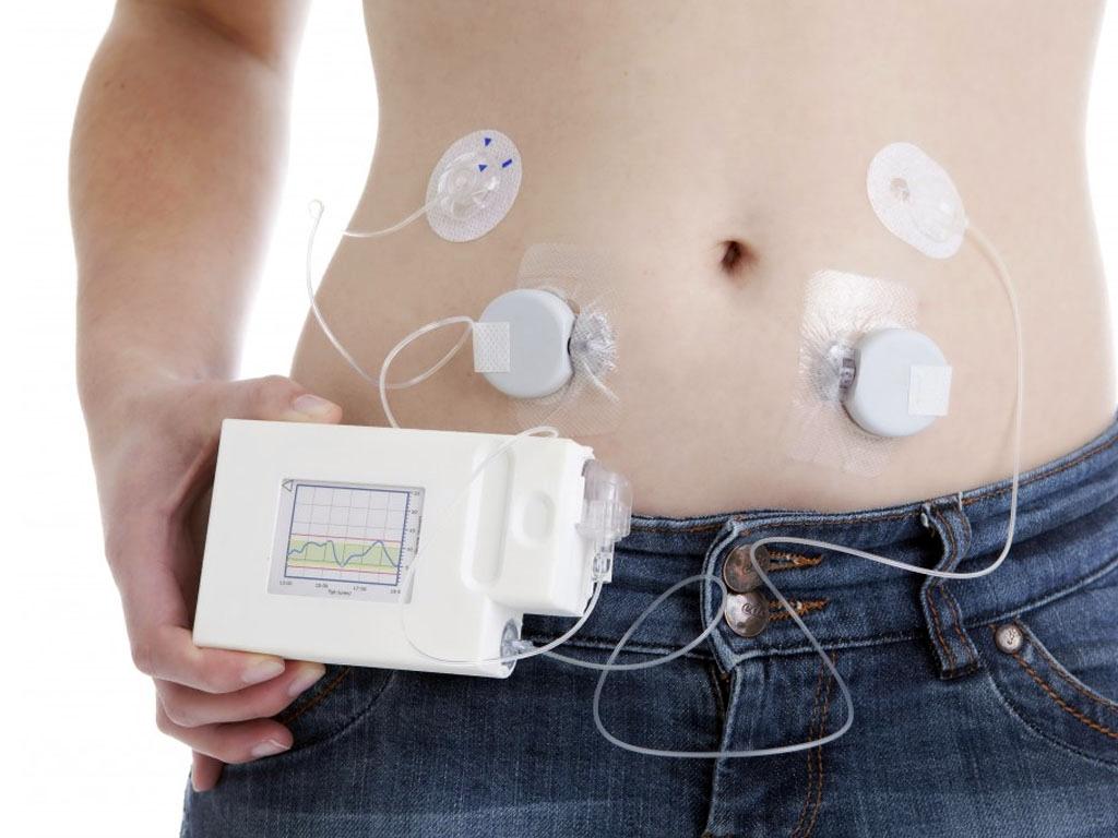 Blood sugar measuring