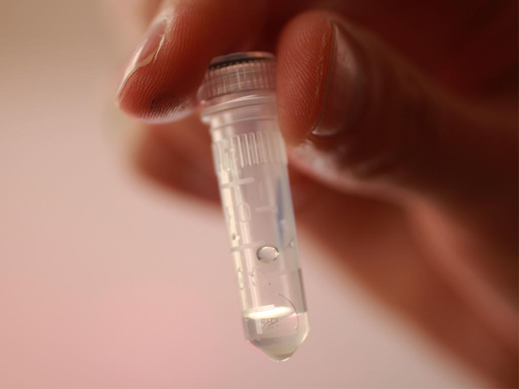 Open Wetlab DNA Fingerprinting