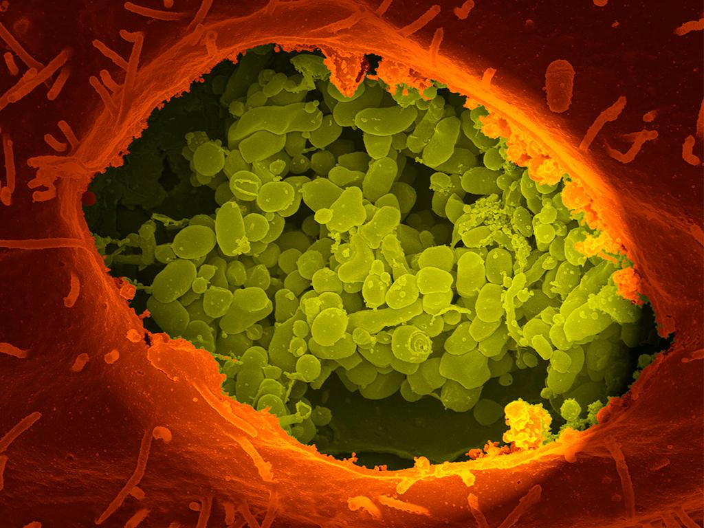 Q fever bacteria (yellow) in an infected cell