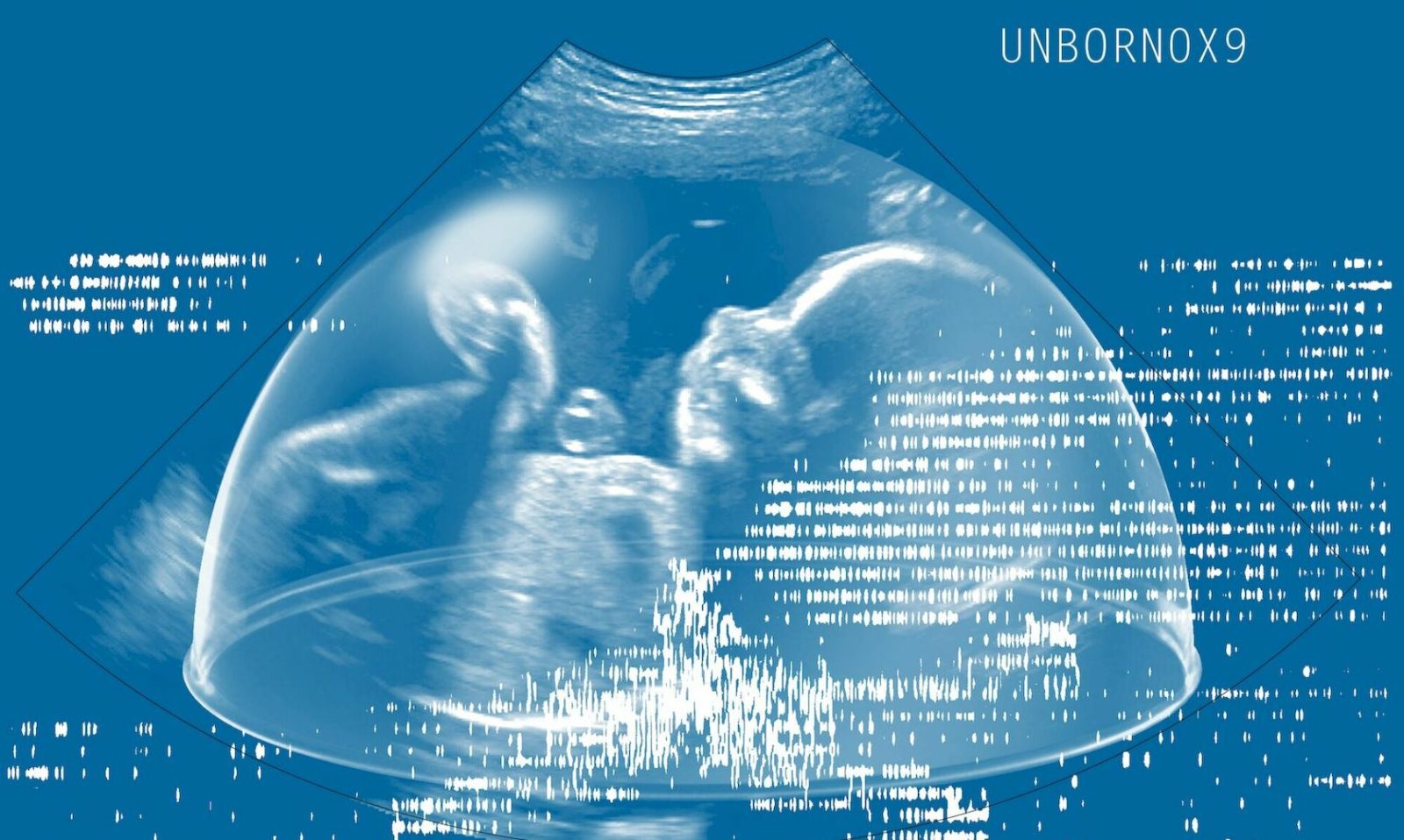 UNBORN0X9, a project by Future Baby Production collective Art4Med