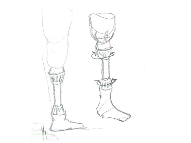 Low Cost Prosthesis sketch Low Cost Prosthesis sketch
