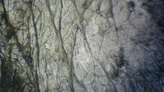 Microscope image of used estradiol patch; credit Adriana Knouf