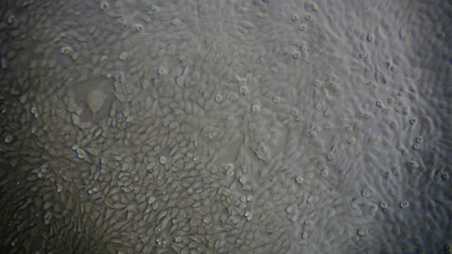 Microscope image of cultured testicular cells; credit Adriana Knouf