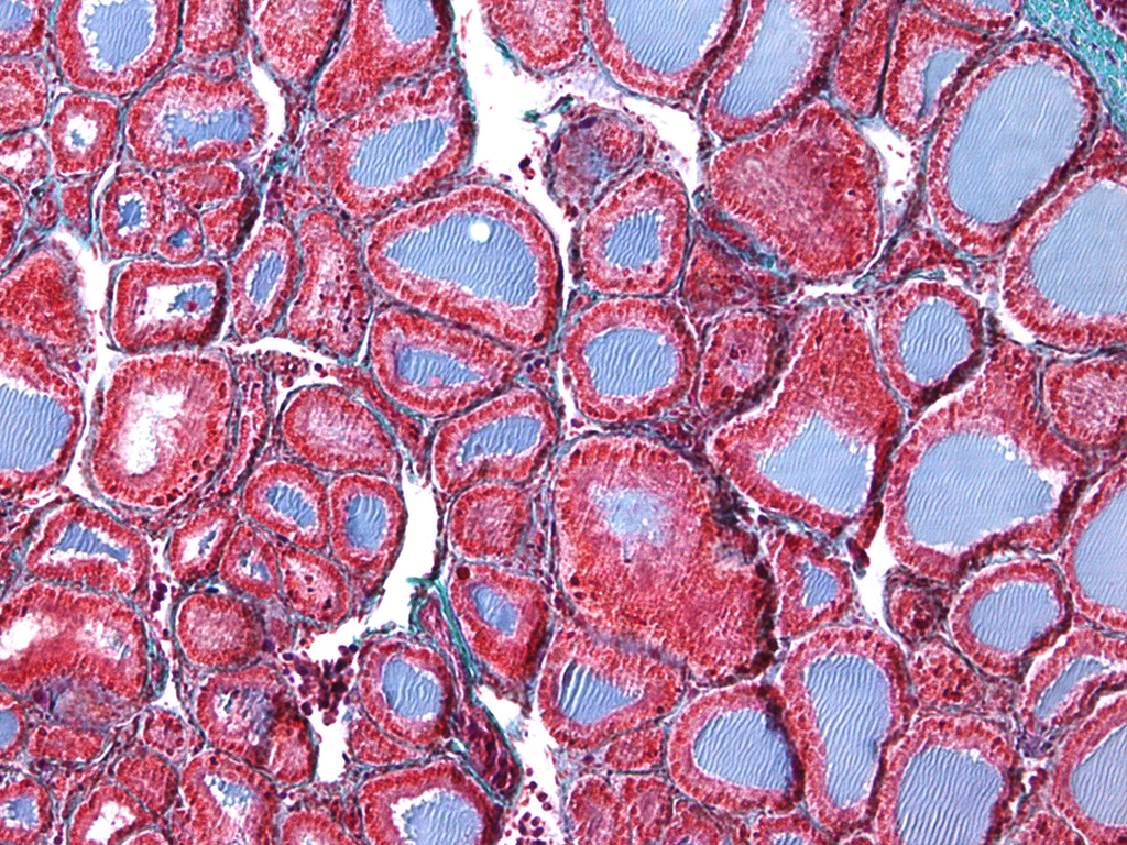 Thyroid gland Thyroid gland